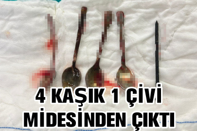 4 kaşık ve 1 çivi çıkarıldı