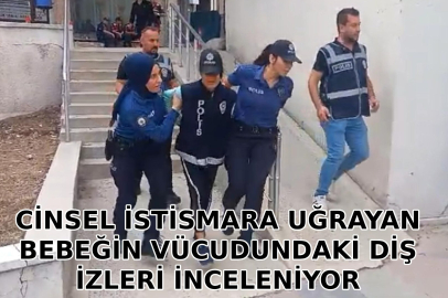 Tekirdağ'da cinsel istismara uğrayan bebeğin vücudundaki diş izleri inceleniyor