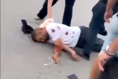 Hemşirenin yaralıya müdahalesinin engellendiği anlar kamerada