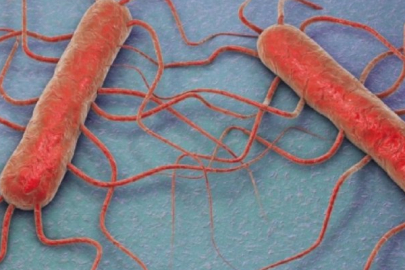 ABD'de listeria bakterisi alarmı verildi