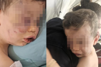 Denizli'de 2 yaşındaki bebeğe vahşeti yaşatan anne ile sevgilisi gözaltında