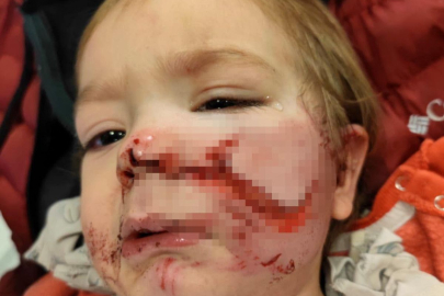 Ankara'da iki çocuğu yaralayan pitbull ve sahibi yakalandı