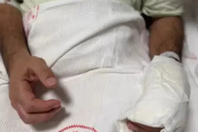 Sıcak torbası patlamasıyla vücudunun yüzde 30'u yandı!