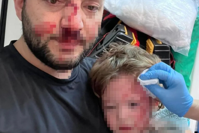 Yalova’da "gürültü" vahşeti! Kucağındaki bebeğiyle saldırıya uğrayan babanın burnu kırıldı, 14 aylık İkra’nın kafatası çatladı