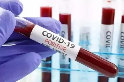 Covid'e yakalandığını çoğu kişi bilmiyor! Vakalarda korkutan artış
