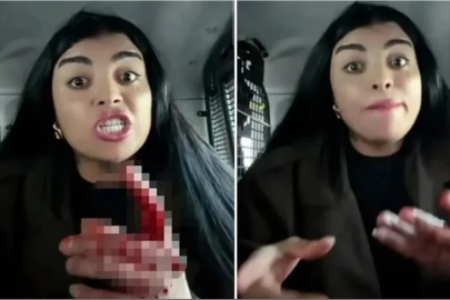 TikTok fenomeni Karagül, sokak ortasında bir kadını yüzünden bıçakladı!