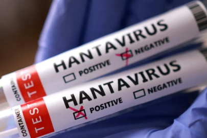 Türkiye'de hantavirüs var mı? Sağlık Bakanlığı'ndan açıklama geldi