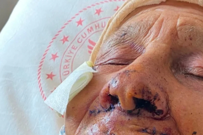 Şanlıurfa'da dehşete düşüren olay: 85 yaşındaki annesini sopayla dövdü