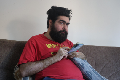 Tedavi sonrası yeniden telefon başına döndü: “İstesem düzelirim ama istemiyorum”